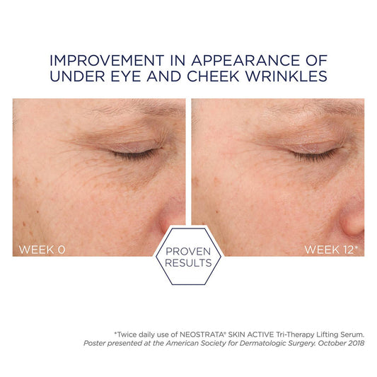 Neostrata Skin Active Tri-Therapy Lifting Serum with Hyaluronic Acid 30ml