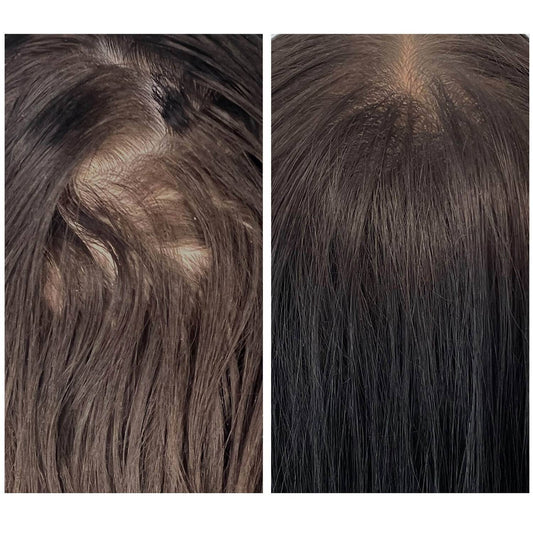 We Are Paradoxx Growth Accelerate Advanced Scalp Serum 50ml