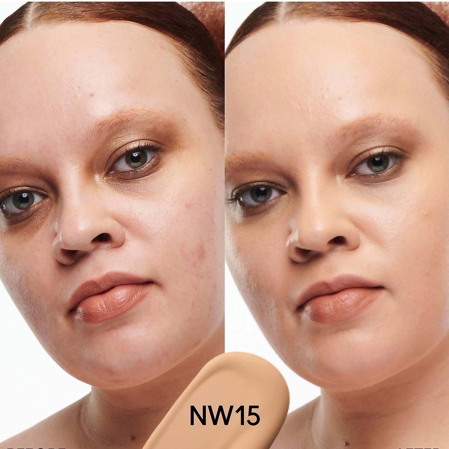 NW15 NW15