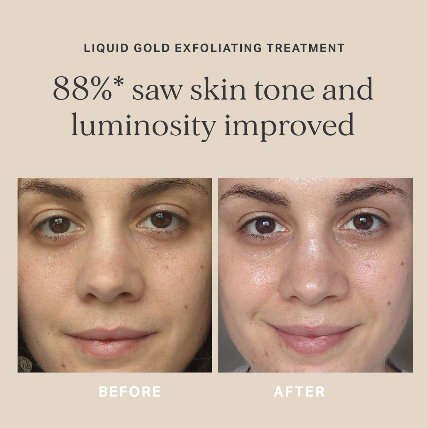 Alpha-H Liquid Gold Exfoliating Treatment with Glycolic Acid 100ml