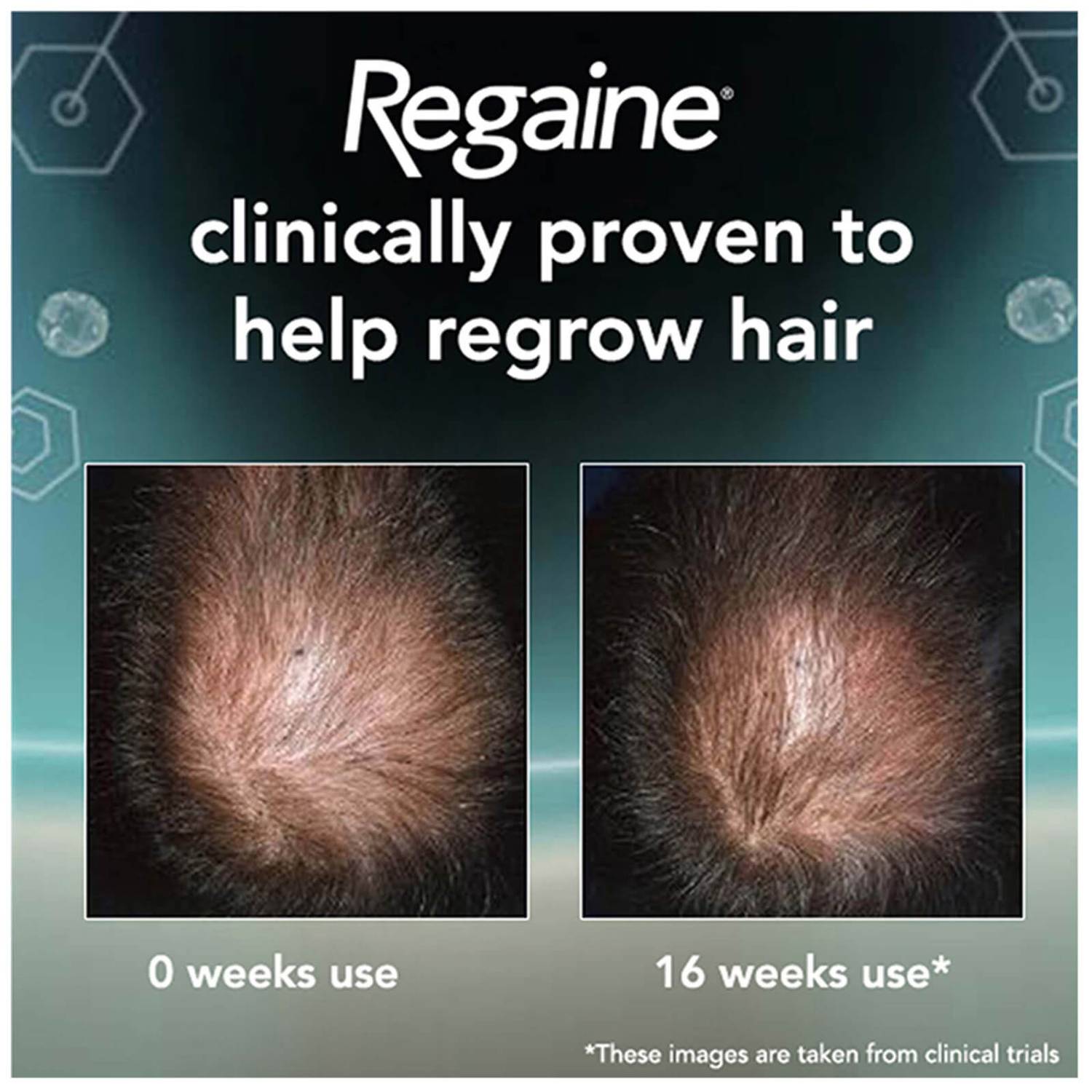 Regaine Men's Extra Strength Hair Loss and Hair Regrowth Scalp Foam Treatment 73ml