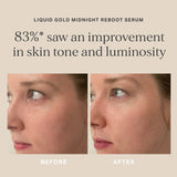 Alpha-H Liquid Gold Midnight Reboot Serum 50ml